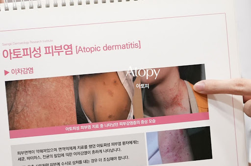 생기한의원 아토피 상담 전 사용 중인 약을 확인해야 하는 이유